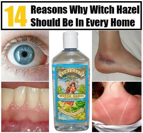 14 Reasons Why Every Home Should Have Witch Hazel
