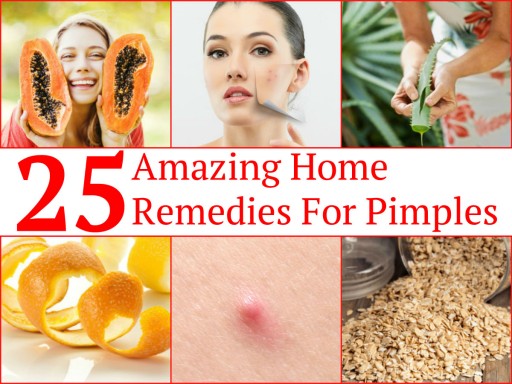 25 Easy Ways To Get Rid OF Embarrassing Pimples Fast At Home