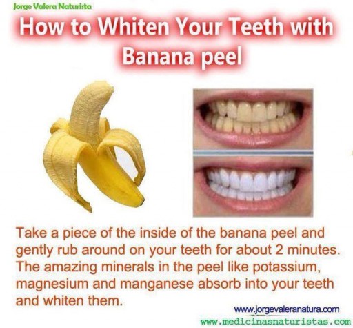 10 Natural Ways For Teeth Whitening 3