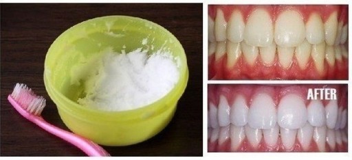 10 Natural Ways For Teeth Whitening